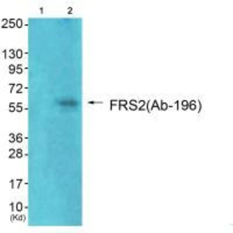 Western blot - FRS2 (Ab-196) Antibody from Signalway Antibody (33254) - Antibodies.com