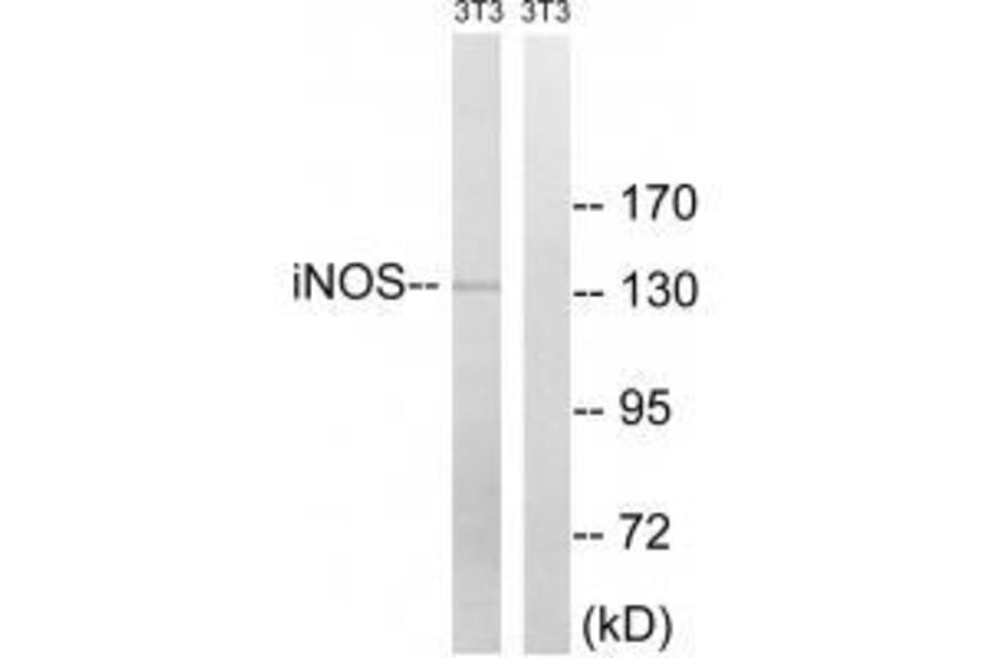 Western blot - iNOS (Ab-151) Antibody from Signalway Antibody (33261) - Antibodies.com