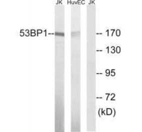 Western blot - 53BP1 (Ab-29) Antibody from Signalway Antibody (33270) - Antibodies.com