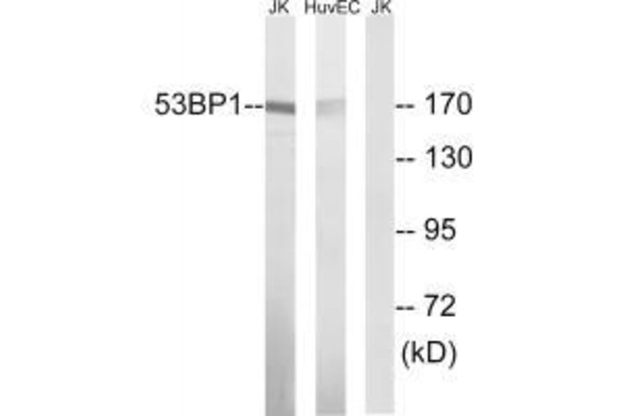 Western blot - 53BP1 (Ab-29) Antibody from Signalway Antibody (33270) - Antibodies.com