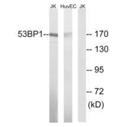 Western blot - 53BP1 (Ab-29) Antibody from Signalway Antibody (33270) - Antibodies.com