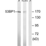 Western blot - 53BP1 (Ab-29) Antibody from Signalway Antibody (33270) - Antibodies.com
