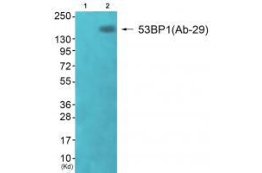 Western blot - 53BP1 (Ab-29) Antibody from Signalway Antibody (33270) - Antibodies.com