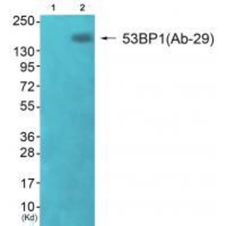 Western blot - 53BP1 (Ab-29) Antibody from Signalway Antibody (33270) - Antibodies.com