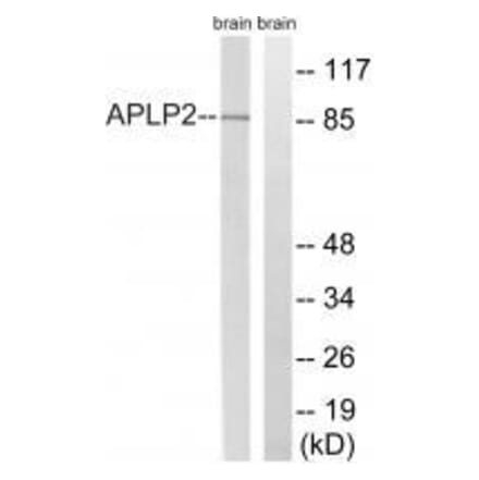 Western blot - APLP2 (Ab-755) Antibody from Signalway Antibody (33274) - Antibodies.com
