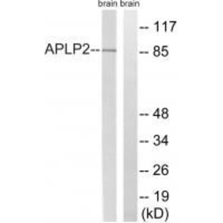 Western blot - APLP2 (Ab-755) Antibody from Signalway Antibody (33274) - Antibodies.com