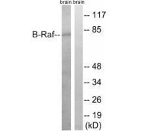 Western blot - B-Raf (Ab-753) Antibody from Signalway Antibody (33277) - Antibodies.com