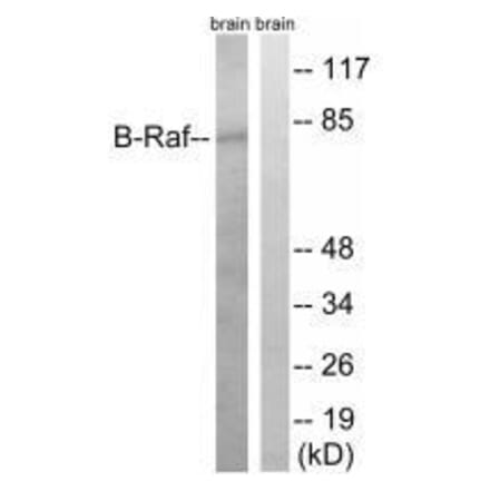 Western blot - B-Raf (Ab-753) Antibody from Signalway Antibody (33277) - Antibodies.com