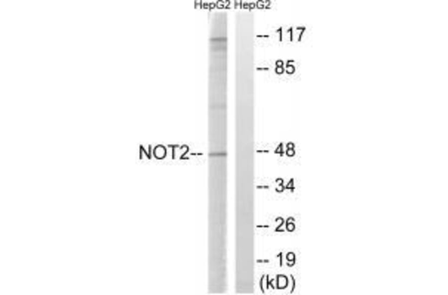 Western blot - CNOT2 (Ab-101) Antibody from Signalway Antibody (33291) - Antibodies.com