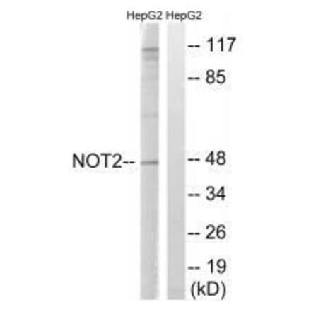 Western blot - CNOT2 (Ab-101) Antibody from Signalway Antibody (33291) - Antibodies.com