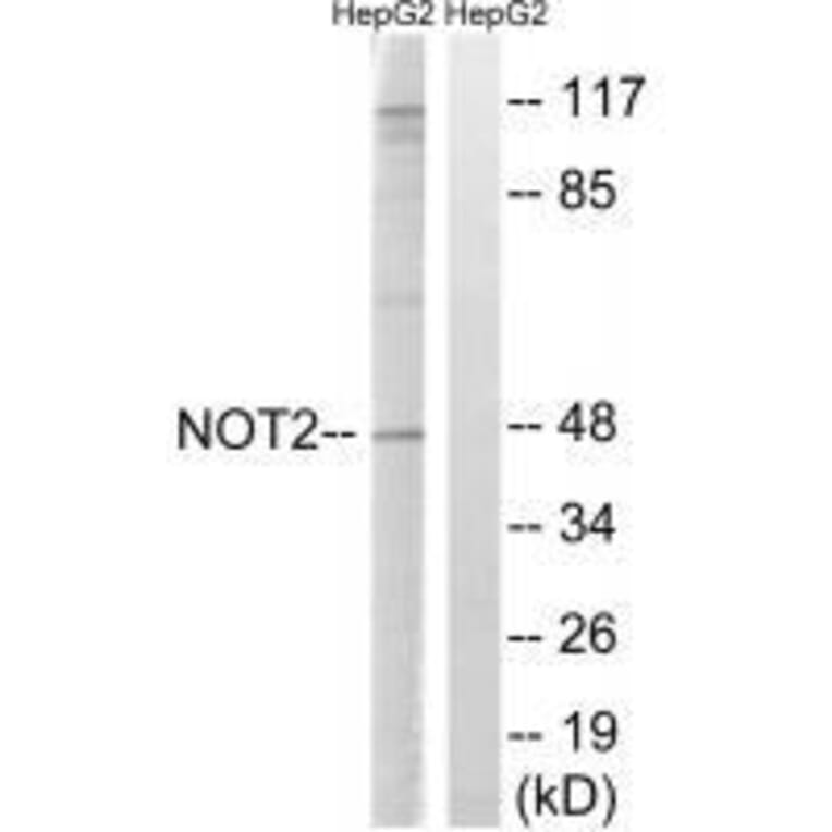 Western blot - CNOT2 (Ab-101) Antibody from Signalway Antibody (33291) - Antibodies.com