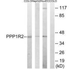 Western blot - PPP1R2 (Ab-44) Antibody from Signalway Antibody (33294) - Antibodies.com