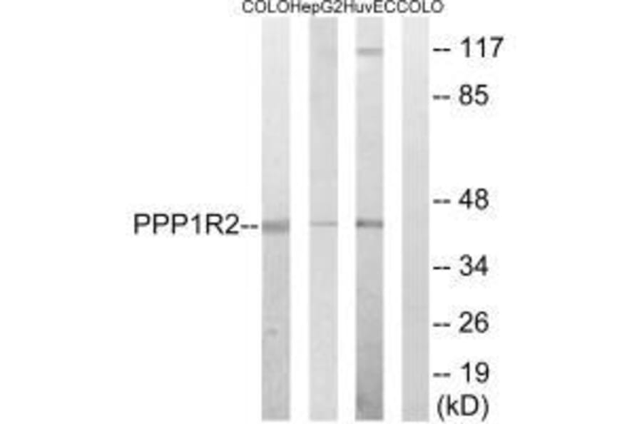 Western blot - PPP1R2 (Ab-44) Antibody from Signalway Antibody (33294) - Antibodies.com