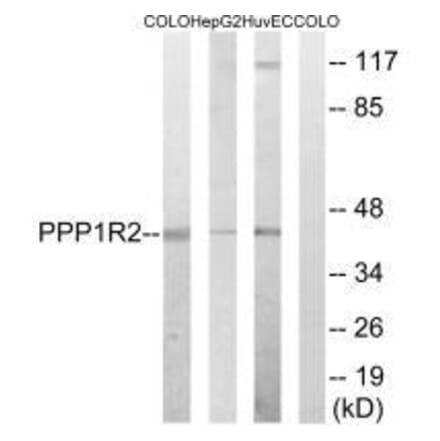 Western blot - PPP1R2 (Ab-44) Antibody from Signalway Antibody (33294) - Antibodies.com