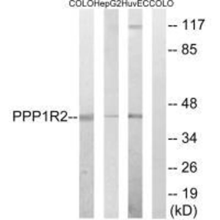 Western blot - PPP1R2 (Ab-44) Antibody from Signalway Antibody (33294) - Antibodies.com
