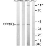Western blot - PPP1R2 (Ab-44) Antibody from Signalway Antibody (33294) - Antibodies.com