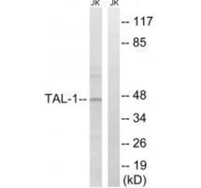 Western blot - TAL-1 (Ab-122) Antibody from Signalway Antibody (33295) - Antibodies.com