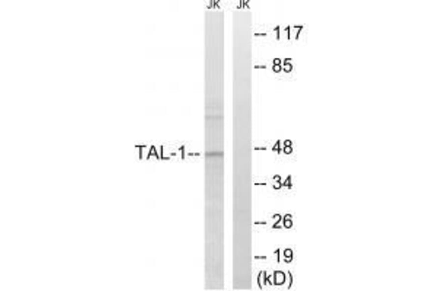 Western blot - TAL-1 (Ab-122) Antibody from Signalway Antibody (33295) - Antibodies.com