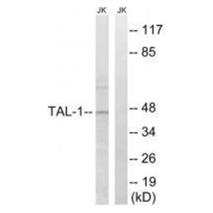 Western blot - TAL-1 (Ab-122) Antibody from Signalway Antibody (33295) - Antibodies.com