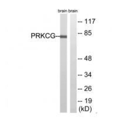 Western blot - PRKCG (Ab-655) Antibody from Signalway Antibody (33304) - Antibodies.com