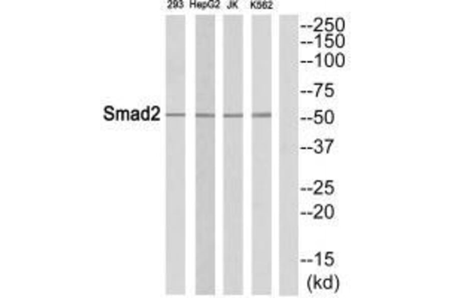 Western blot - Smad2 (Ab-465) Antibody from Signalway Antibody (33316) - Antibodies.com