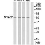 Western blot - Smad2 (Ab-465) Antibody from Signalway Antibody (33316) - Antibodies.com
