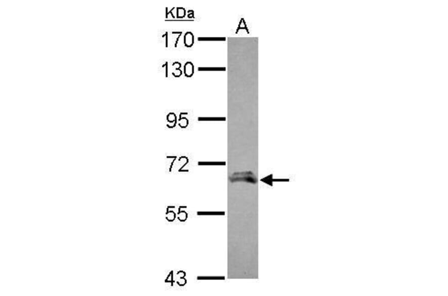 Angiopoietin 2 Antibody from Signalway Antibody (35354) - Antibodies.com