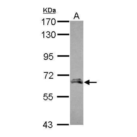 Angiopoietin 2 Antibody from Signalway Antibody (35354) - Antibodies.com