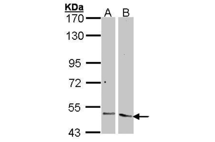 Angiopoietin 2 Antibody from Signalway Antibody (35354) - Antibodies.com