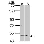 Angiopoietin 2 Antibody from Signalway Antibody (35354) - Antibodies.com