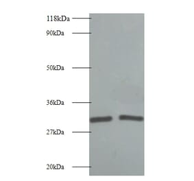 L-lactate dehydrogenase A chain Polyclonal Antibody from Signalway Antibody (42054) - Antibodies.com