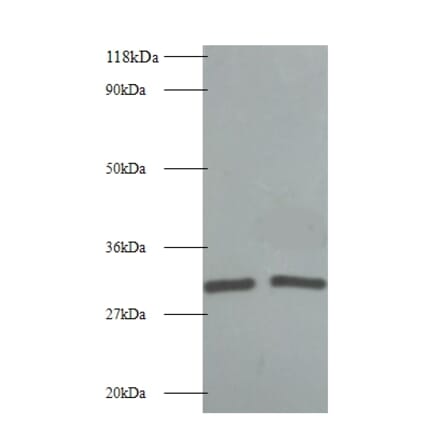 L-lactate dehydrogenase A chain Polyclonal Antibody from Signalway Antibody (42054) - Antibodies.com