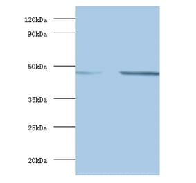 Spliceosome RNA helicase DDX39B Polyclonal Antibody from Signalway Antibody (42086) - Antibodies.com