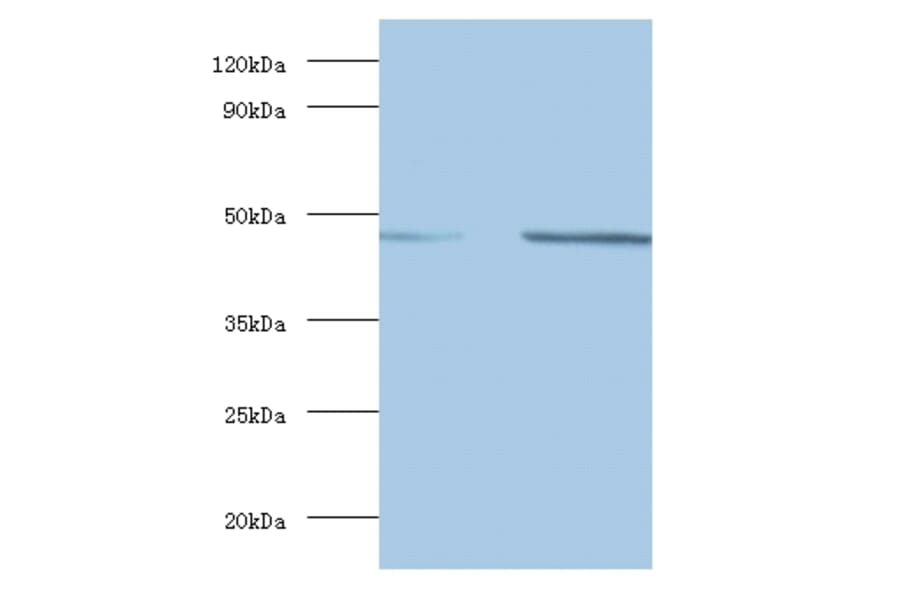 Spliceosome RNA helicase DDX39B Polyclonal Antibody from Signalway Antibody (42086) - Antibodies.com