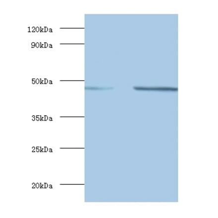 Spliceosome RNA helicase DDX39B Polyclonal Antibody from Signalway Antibody (42086) - Antibodies.com