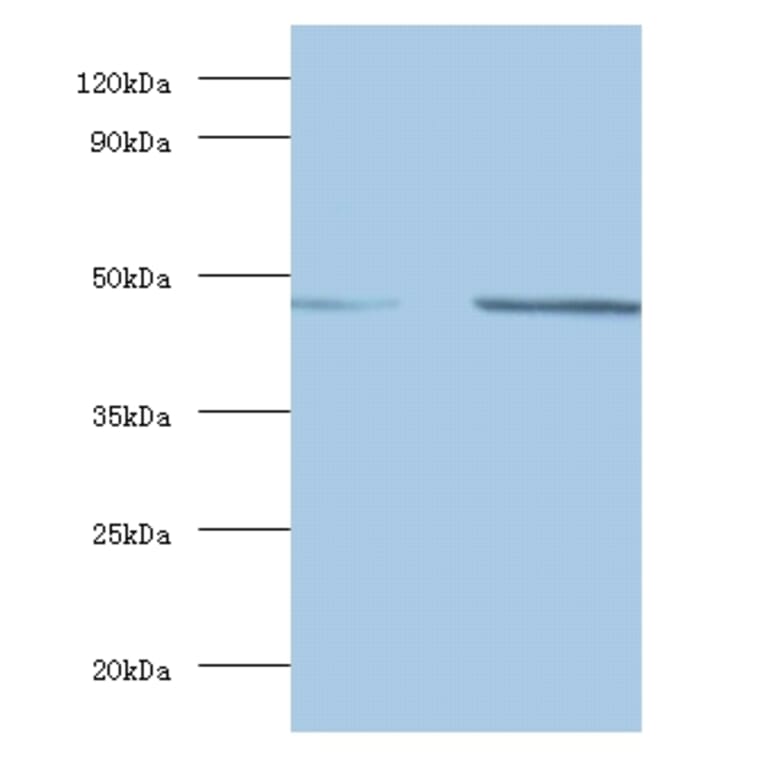 Spliceosome RNA helicase DDX39B Polyclonal Antibody from Signalway Antibody (42086) - Antibodies.com