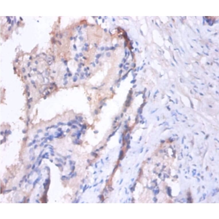 Immunohistochemistry - Spliceosome RNA helicase DDX39B Polyclonal Antibody from Signalway Antibody (42086)