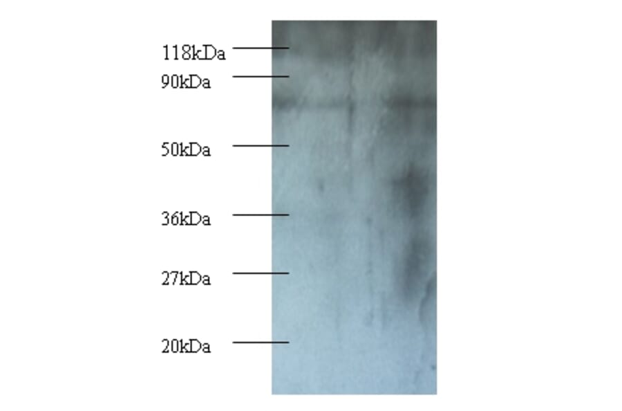 Casein kinase I isoform epsilon Polyclonal Antibody from Signalway Antibody (42244) - Antibodies.com