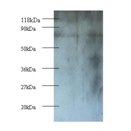 Casein kinase I isoform epsilon Polyclonal Antibody from Signalway Antibody (42244) - Antibodies.com