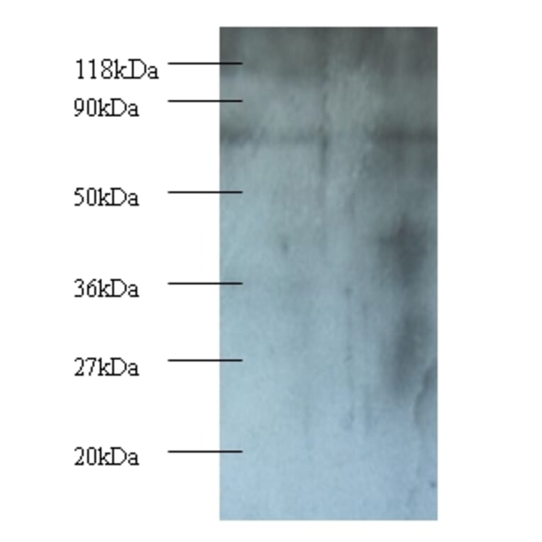 Casein kinase I isoform epsilon Polyclonal Antibody from Signalway Antibody (42244) - Antibodies.com