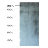 Casein kinase I isoform epsilon Polyclonal Antibody from Signalway Antibody (42244) - Antibodies.com