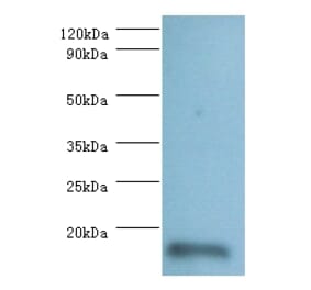 60S ribosomal protein L36a-like Polyclonal Antibody from Signalway Antibody (42293) - Antibodies.com