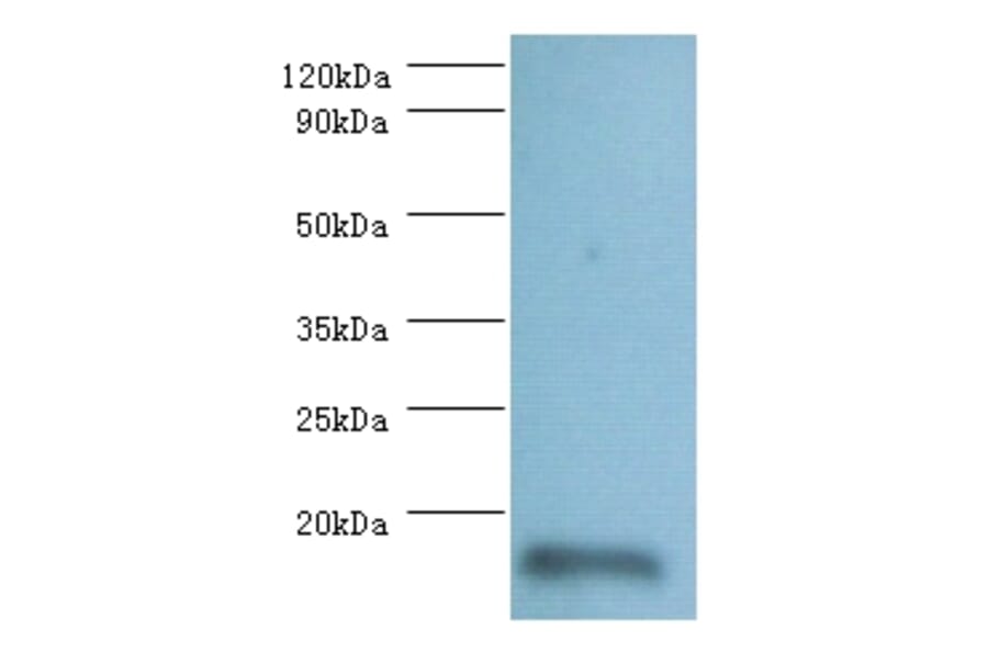 60S ribosomal protein L36a-like Polyclonal Antibody from Signalway Antibody (42293) - Antibodies.com