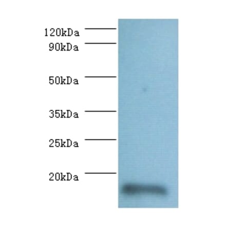 60S ribosomal protein L36a-like Polyclonal Antibody from Signalway Antibody (42293) - Antibodies.com