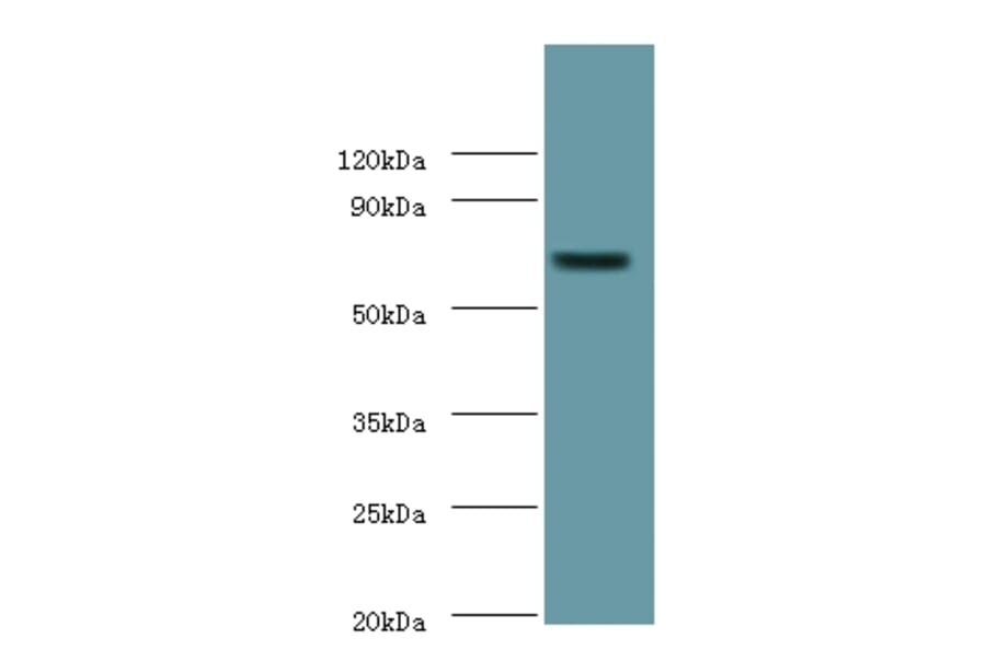 Putative phospholipase B-like 2 Polyclonal Antibody from Signalway Antibody (42295) - Antibodies.com