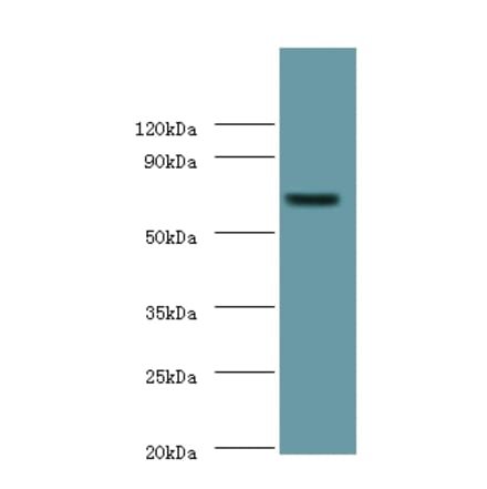 Putative phospholipase B-like 2 Polyclonal Antibody from Signalway Antibody (42295) - Antibodies.com