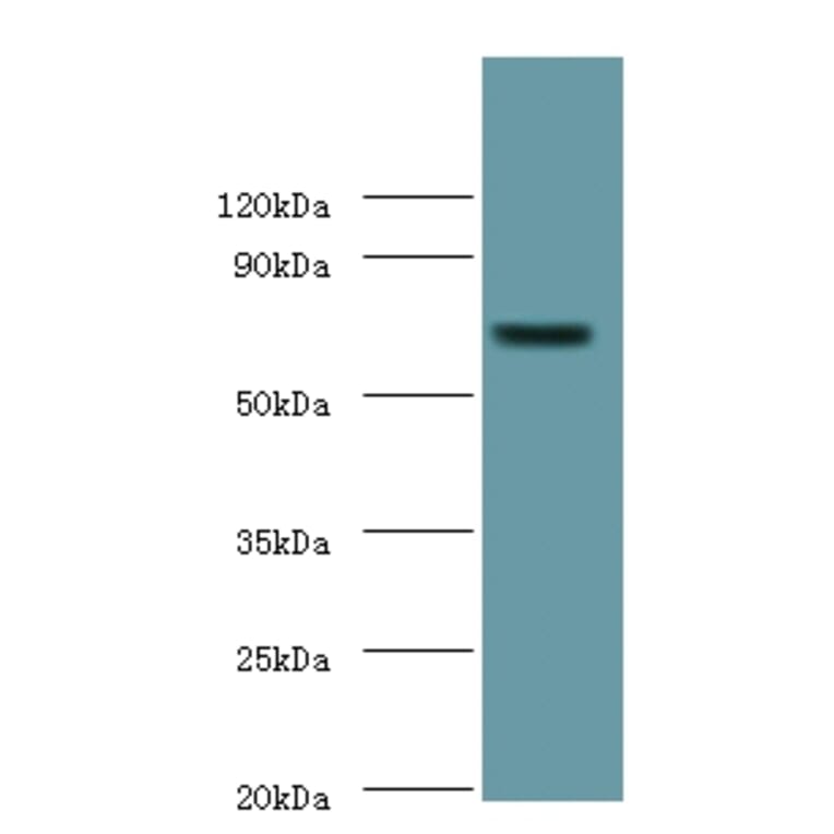 Putative phospholipase B-like 2 Polyclonal Antibody from Signalway Antibody (42295) - Antibodies.com
