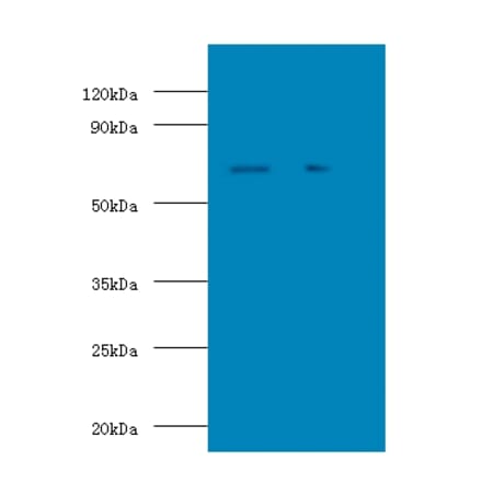Stress-induced-phosphoprotein 1 Polyclonal Antibody from Signalway Antibody (42335) - Antibodies.com