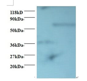 Programmed cell death protein 6 Polyclonal Antibody from Signalway Antibody (42418) - Antibodies.com