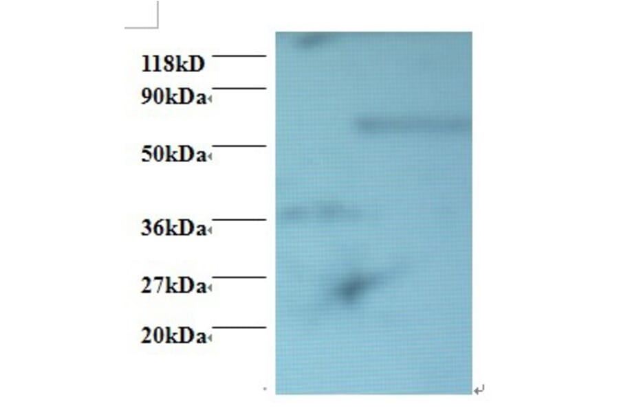 Programmed cell death protein 6 Polyclonal Antibody from Signalway Antibody (42418) - Antibodies.com